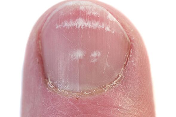 Los primeros signos y síntomas