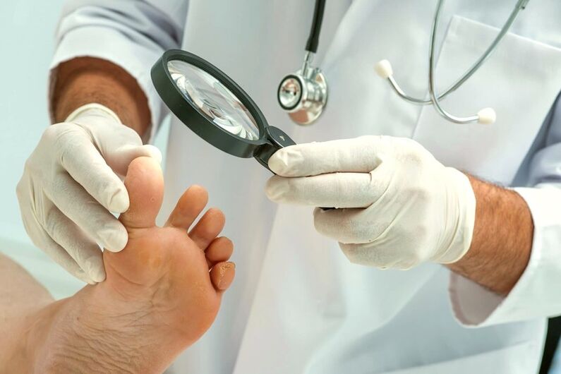 El dermatólogo examina las uñas de los pies