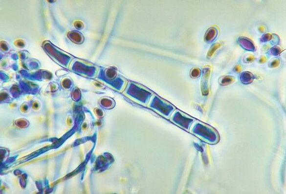 Hongo Trichophyton rubrum bajo el microscopio