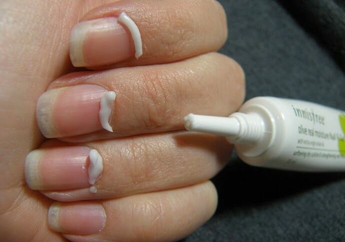 Tratamiento de hongos en las uñas con ungüento.